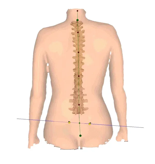 DIERS formetric 4D radiation-free spine and posture analysis system